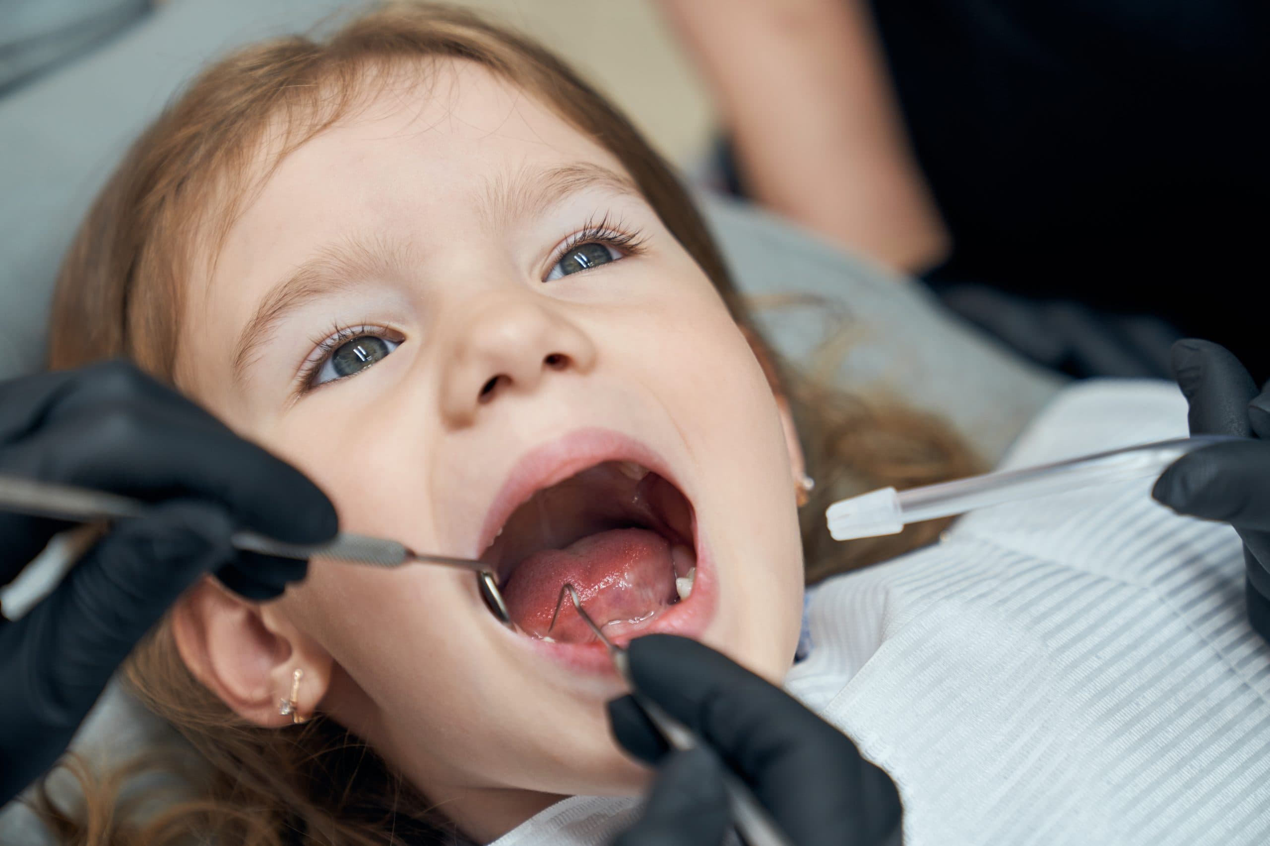 Preventive Dental Care for 0–3 Year Olds